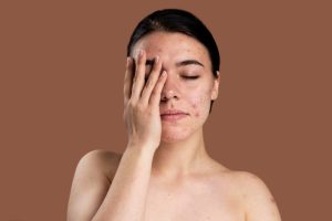 Liang pori yang wujud pada kulit kita boleh menjadi tertutup oleh sisa minyak, sel kulit mati, dan debu. Ini boleh menyebabkan masalah kulit seperti jerawat, komedo, kemeradanan, muka meneput dan berminyak.